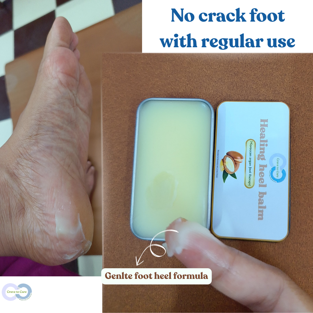 Healing heel balm